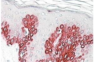 AP23761PU-N SIRT1 antibody staining of paraffin embedded Human Skin at 3. (SIRT1 抗体  (Internal Region))