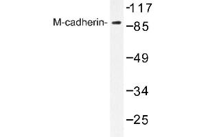 Image no. 1 for anti-M-Cadherin (CDH15) antibody (ABIN272294) (CDH15 抗体)