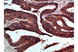Immunohistochemistry (IHC) image for anti-Cyclin-Dependent Kinase 6 (CDK6) (AA 280-325) antibody (ABIN7189478)