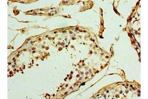 Immunohistochemistry of paraffin-embedded human testis tissue using ABIN7159831 at dilution of 1:100 (UCP1 抗体  (AA 1-307))