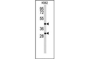 Western blot analysis of DFFA / ICAD Antibody (C-term) in K562 cell line lysates (35ug/lane). (DFFA 抗体  (C-Term))