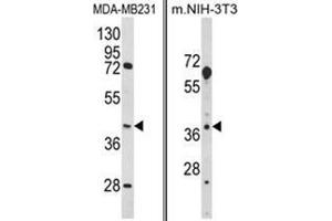 (LEFT) Western blot analysis of HOMER3 Antibody (Center) in MDA-MB231 cell line lysates (35ug/lane). (HOMER3 抗体  (Middle Region))