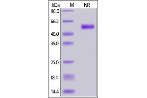 SDS-PAGE (SDS) image for Tumor Necrosis Factor (Ligand) Superfamily, Member 13b (TNFSF13B) (AA 140-285) (Active) protein (His tag,DYKDDDDK Tag) (ABIN7013542)