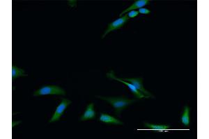 Immunofluorescence of purified MaxPab antibody to RIOK2 on HeLa cell. (RIOK2 抗体  (AA 1-552))