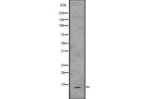 Western blot analysis S100A9 using 293 whole cell lysates (S100A9 抗体)