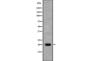 Western blot analysis IL17B using Jurkat whole cell lysates (IL17B 抗体  (Internal Region))