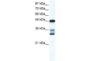 TNFSF10 antibody (70R-10455) used at 0. (TRAIL 抗体  (N-Term))