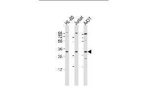 All lanes : Anti-CASP3 Antibody (Center) at 1:2000 dilution Lane 1: HL-60 whole cell lysate Lane 2: Jurkat whole cell lysate Lane 3: A431 whole cell lysate Lysates/proteins at 20 μg per lane. (Caspase 3 抗体  (AA 60-90))