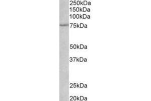 AP31775PU-N NGFR antibody staining of Rat Heart lysate at 1 µg/ml (35 µg protein in RIPA buffer). (NGFR 抗体  (Internal Region))