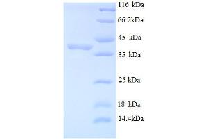 SDS-PAGE (SDS) image for Mindbomb E3 Ubiquitin Protein Ligase 1 (MIB1) (AA 5-332), (partial) protein (His tag) (ABIN1046954)