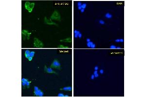 Immunofluorescence (IF) image for anti-Actin, alpha 2, Smooth Muscle, Aorta (ACTA2) (N-Term) antibody (ABIN185271)