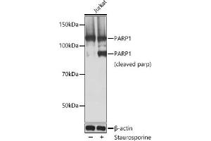 Western blot analysis of extracts of Jurkat cells, using P antibody  at 1:1000 dilution. (PARP1 抗体)