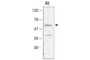 Western blot analysis of Arabidopsis chloroplast proteins with anti-STN8 kinase (STN8 Kinase 抗体)
