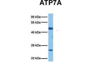 Host:  Rabbit  Target Name:  ATP7A  Sample Tissue:  Human Ovary Tumor  Antibody Dilution:  1. (ATP7A 抗体  (N-Term))