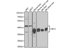 Western blot analysis of extracts of various cell lines, using SIRT2 antibody (ABIN6291363) at 1:1000 dilution. (SIRT2 抗体)