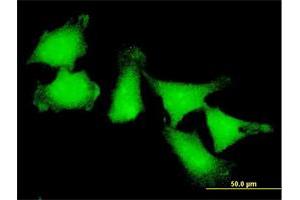Immunofluorescence (IF) image for anti-ATX1 Antioxidant Protein 1 Homolog (ATOX1) (AA 1-68) antibody (ABIN513595)