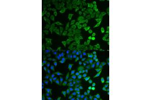 Immunofluorescence analysis of HeLa cell using NPRL2 antibody. (NPRL2 抗体)