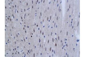 Formalin-fixed and paraffin embedded rat myocardium labeled with Anti-TNFAIP3 Polyclonal Antibody, Unconjugated (ABIN680938) at 1:200 followed by conjugation to the secondary antibody and DAB staining (TNFAIP3 抗体  (AA 51-150))
