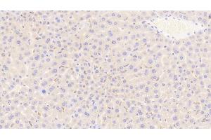Detection of CD163 in Mouse Liver Tissue using Polyclonal Antibody to Cluster Of Differentiation (CD163) (CD163 抗体  (AA 697-972))