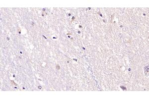 Detection of NT3 in Human Cerebrum Tissue using Monoclonal Antibody to Neurotrophin 3 (NT3) (Neurotrophin 3 抗体  (AA 130-255))