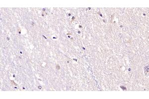 Detection of NT3 in Human Cerebrum Tissue using Monoclonal Antibody to Neurotrophin 3 (NT3)