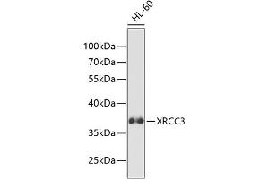 Western blot analysis of extracts of HL-60 cells, using XRCC3 antibody (ABIN3023005, ABIN3023006, ABIN3023007 and ABIN6219342) at 1:1000 dilution. (XRCC3 抗体  (AA 62-346))