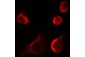ABIN6278566 staining LOVO cells by IF/ICC. (EIF4E3 抗体  (Internal Region))