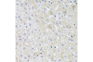 Immunohistochemistry of paraffin-embedded rat liver using SLC4A5 antibody (ABIN5998866) at dilution of 1/100 (40x lens). (NBC4 抗体)