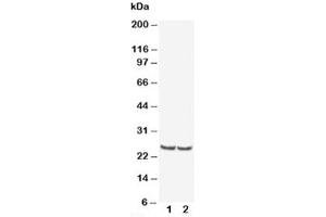 Western blot testing of TIMP4 antibody and Lane 1:  rat kidney (TIMP4 抗体  (AA 208-224))