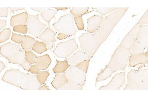 Detection of DMD in Human Skeletal muscle Tissue using Polyclonal Antibody to Dystrophin (DMD) (Dystrophin 抗体  (AA 3048-3328))