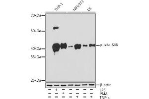 Western Blotting (WB) image for anti-Nuclear Factor of kappa Light Polypeptide Gene Enhancer in B-Cells Inhibitor, alpha (NFKBIA) (pSer36) antibody (ABIN7268992)