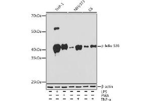 Western blot analysis of extracts of various cell lines, using Phospho-IκBα-S36 Rabbit mAb (ABIN7268992) at 1:1000 dilution. (NFKBIA 抗体  (pSer36))