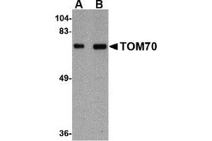Western Blotting (WB) image for anti-Translocase of Outer Mitochondrial Membrane 70 (TOMM70A) (Middle Region) antibody (ABIN1031140) (TOM70 抗体  (Middle Region))