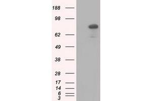 HEK293T cells were transfected with the pCMV6-ENTRY control (Left lane) or pCMV6-ENTRY C17orf28 (Right lane) cDNA for 48 hrs and lysed. (HID1/DMC1 抗体)