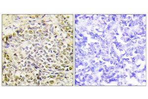 Immunohistochemistry (IHC) image for anti-Iroquois Homeobox Protein 2 (IRX2) (Internal Region) antibody (ABIN1849950) (IRX2 抗体  (Internal Region))