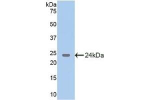 Western Blotting (WB) image for anti-Glutamate Decarboxylase 2 (Pancreatic Islets and Brain, 65kDa) (GAD2) (AA 188-374) antibody (ABIN7437707)