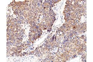 IHC analysis of RPL8 using anti-RPL8 antibody (ABIN7601179). (RPL8 抗体  (AA 3-257))