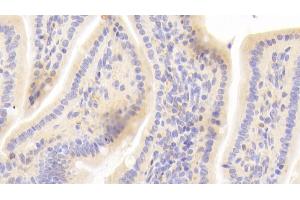 Immunohistochemistry (IHC) image for anti-Peptidylprolyl Isomerase A (Cyclophilin A) (PPIA) (AA 2-164) antibody (ABIN7432964)