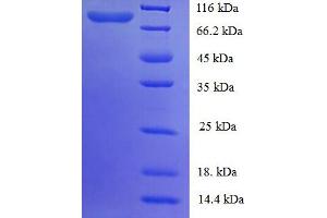 SDS-PAGE (SDS) image for P450 (Cytochrome) Oxidoreductase (POR) (AA 2-671), (partial) protein (GST tag) (ABIN5710131) (POR Protein (AA 2-671, partial) (GST tag))