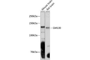 Western blot analysis of extracts of various cell lines, using GM130 Rabbit mAb (ABIN7267494) at 1:1000 dilution. (Golgin A2 (GOLGA2) 抗体)