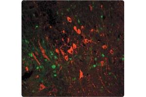 Tissue section through an adult Mouse brain showing TYH (red staining) in catecholaminergic neurons of the substantia nigra (pars compacta). (Tyrosine Hydroxylase 抗体)