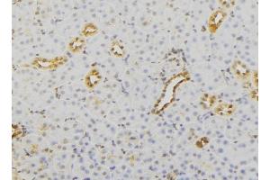 ABIN6279732 at 1/100 staining Mouse kidney tissue by IHC-P. (RAB23 抗体  (C-Term))