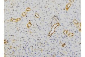 ABIN6279732 at 1/100 staining Mouse kidney tissue by IHC-P. (RAB23 抗体  (C-Term))