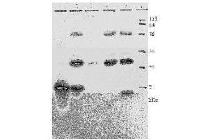 Western Blotting (WB) image for anti-Human Papilloma Virus 18 E7 (HPV-18 E7) (AA 36-70) antibody (ABIN781778) (HPV18 E7 抗体  (AA 36-70))