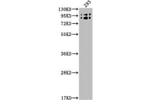 Western Blot Positive WB detected in: 293 whole cell lysate All lanes: BCHE antibody at 1:2000 Secondary Goat polyclonal to rabbit IgG at 1/50000 dilution Predicted band size: 69 kDa Observed band size: 90 kDa (Recombinant Butyrylcholinesterase 抗体)