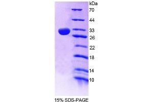 SDS-PAGE analysis of Mouse PLCe1 Protein. (PLCE1 蛋白)