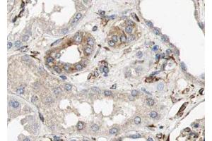 ABIN6279137 at 1/100 staining human kidney tissue sections by IHC-P. (AQP6 抗体  (Internal Region))