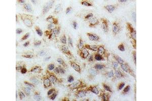 Immunocytochemistry (ICC) image for anti-SMAD, Mothers Against DPP Homolog 1 (SMAD1) (C-Term) antibody (ABIN3032612)