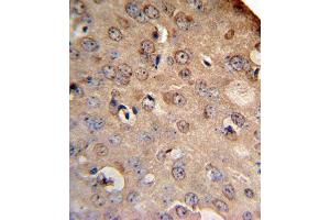 Immunohistochemistry (Paraffin-embedded Sections) (IHC (p)) image for anti-Solute Carrier Family 8 (Sodium/calcium Exchanger), Member 1 (SLC8A1) (AA 296-325) antibody (ABIN652886)