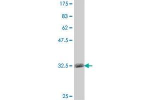 Western Blot detection against Immunogen (34. (PKC beta 抗体  (AA 261-341))